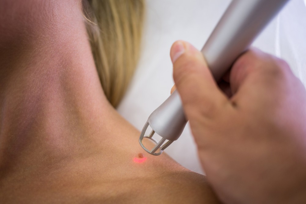 PIGMENTATION TREATMENT